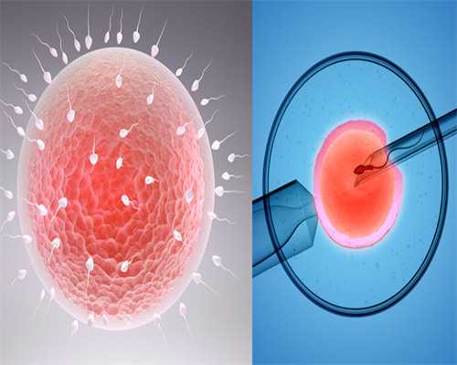 基础卵泡数量对试管婴儿取卵的影响及优化策略