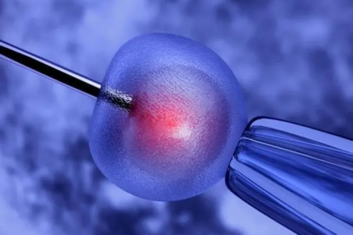 可靠的辅助生殖公司，辅助生殖费用是多少