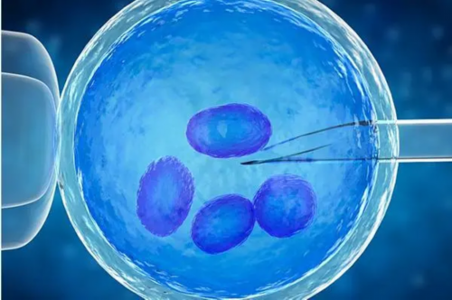 人工授精与试管婴儿：助孕技术的区别与选择