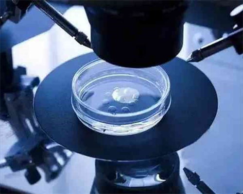 解析精子检查的重要性与费用，助您优生优育