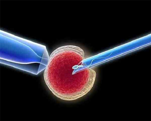 <strong>西安代孕卵子公司,西安唐都医院精子库怎么样,西安唐都医院怎么样</strong>