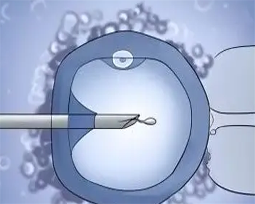 西安代生公司解析：赴美试管婴儿生一胎与二胎的费用与成功率差异