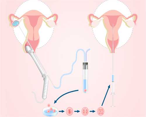 西安试管助孕优选：供卵试管婴儿流程详解与费用咨询