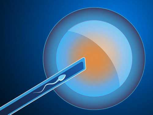 西安代孕网揭秘：为何美国试管婴儿倾向于第五天囊胚移植？