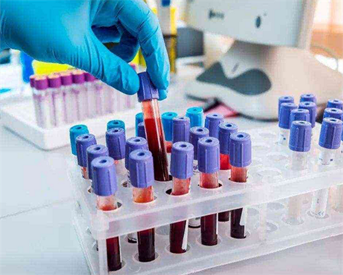 西安哪里可以做供卵？白带异常对美国试管婴儿周期有何影响？_西安代生生子