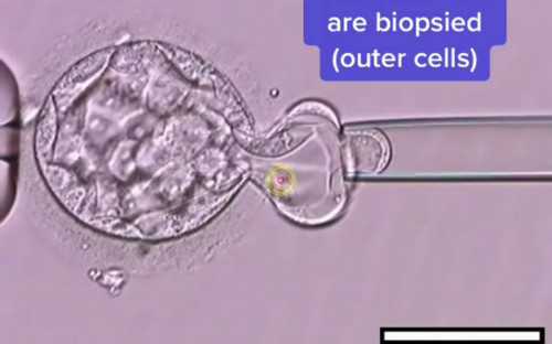 西安试管助孕费用解析与医院选择：了解代生、代怀及供卵流程的关键考量