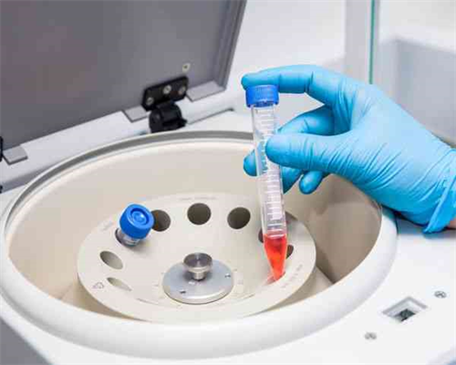 西安助孕指南：俄罗斯三代试管选性别靠谱吗？国内辅助生殖限制与供卵代怀解析