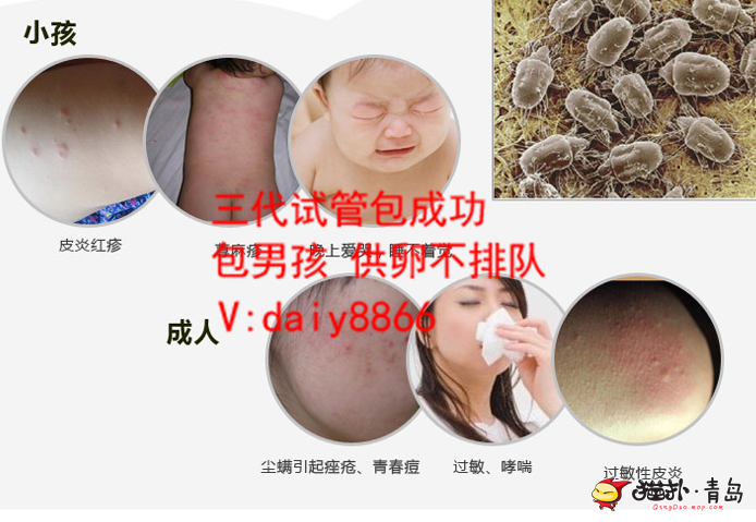 山东供卵家庭_上海国妇婴第三代试管婴儿胚胎筛查多少钱